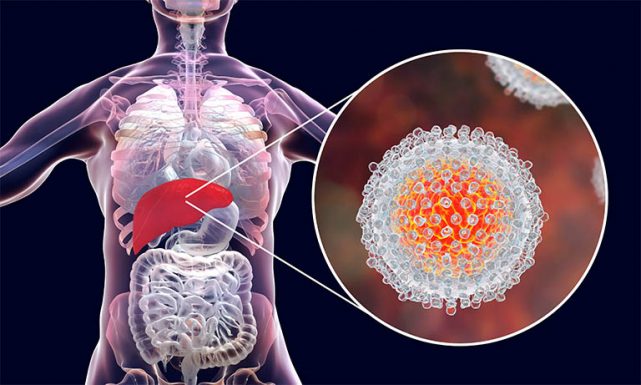 Bệnh viêm gan C điều trị thế nào để giúp gan nhanh khỏe mạnh